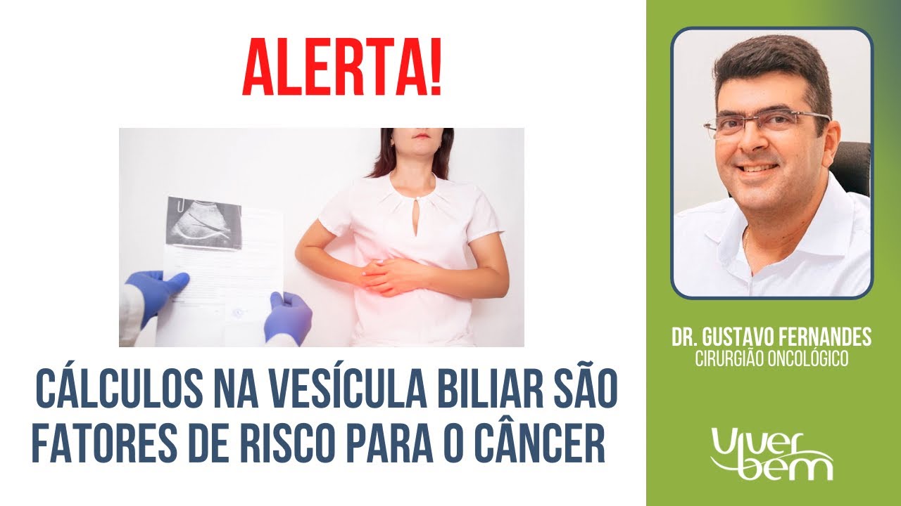 Cálculos na vesícula biliar são fatores de risco para o câncer