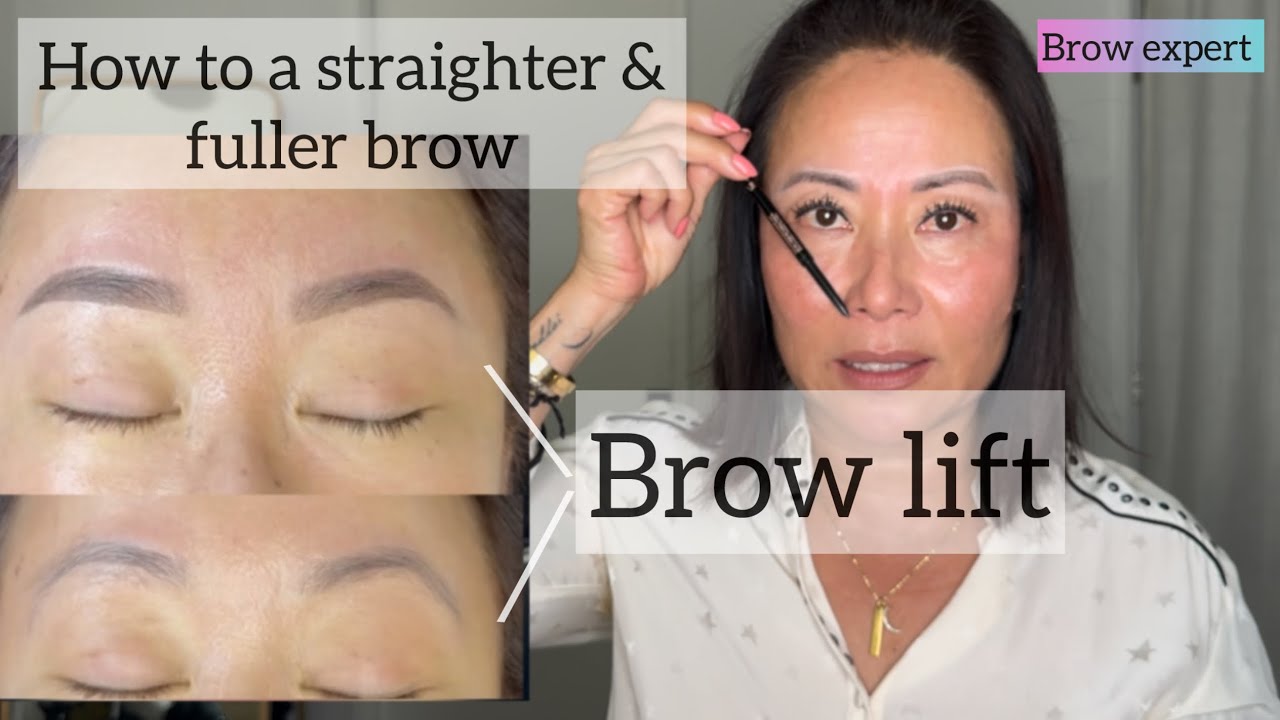 #Brow lift