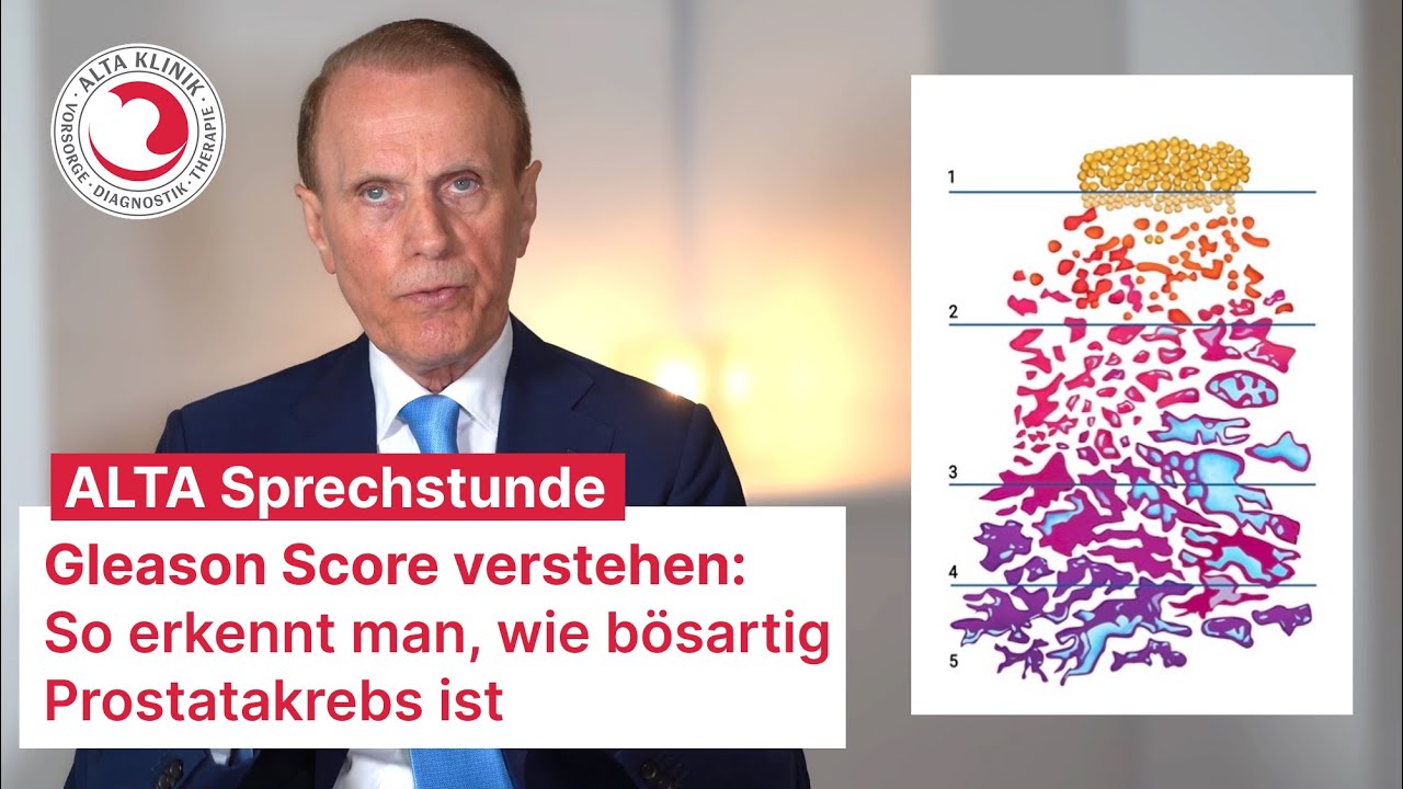 Gleason Score verstehen: So erkennt man, wie bösartig Prostatakrebs ist
