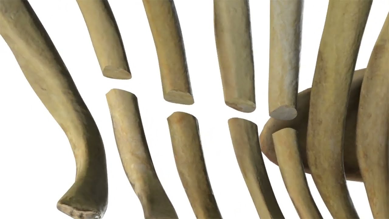 RibFix® Advantage Animation | Zimmer Biomet