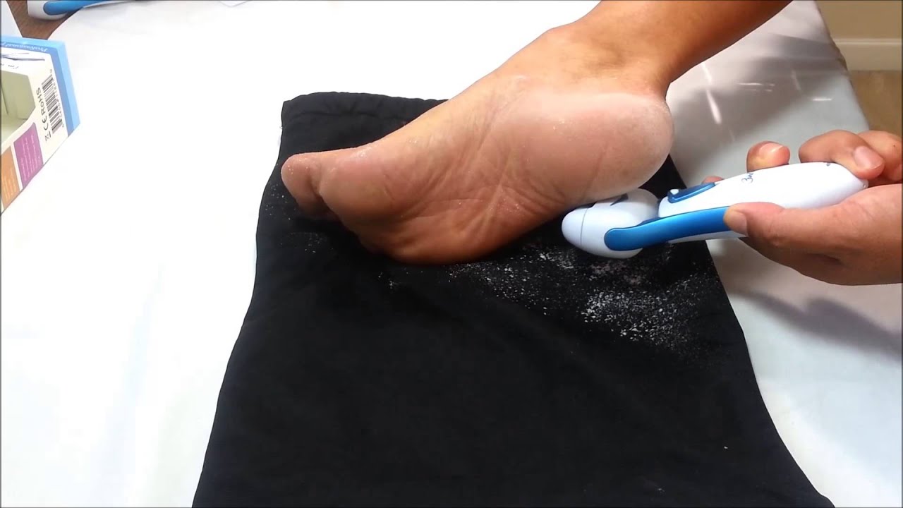 Top Rated Callus Remover by Care me- Seeing is Believing! Go Barefoot!