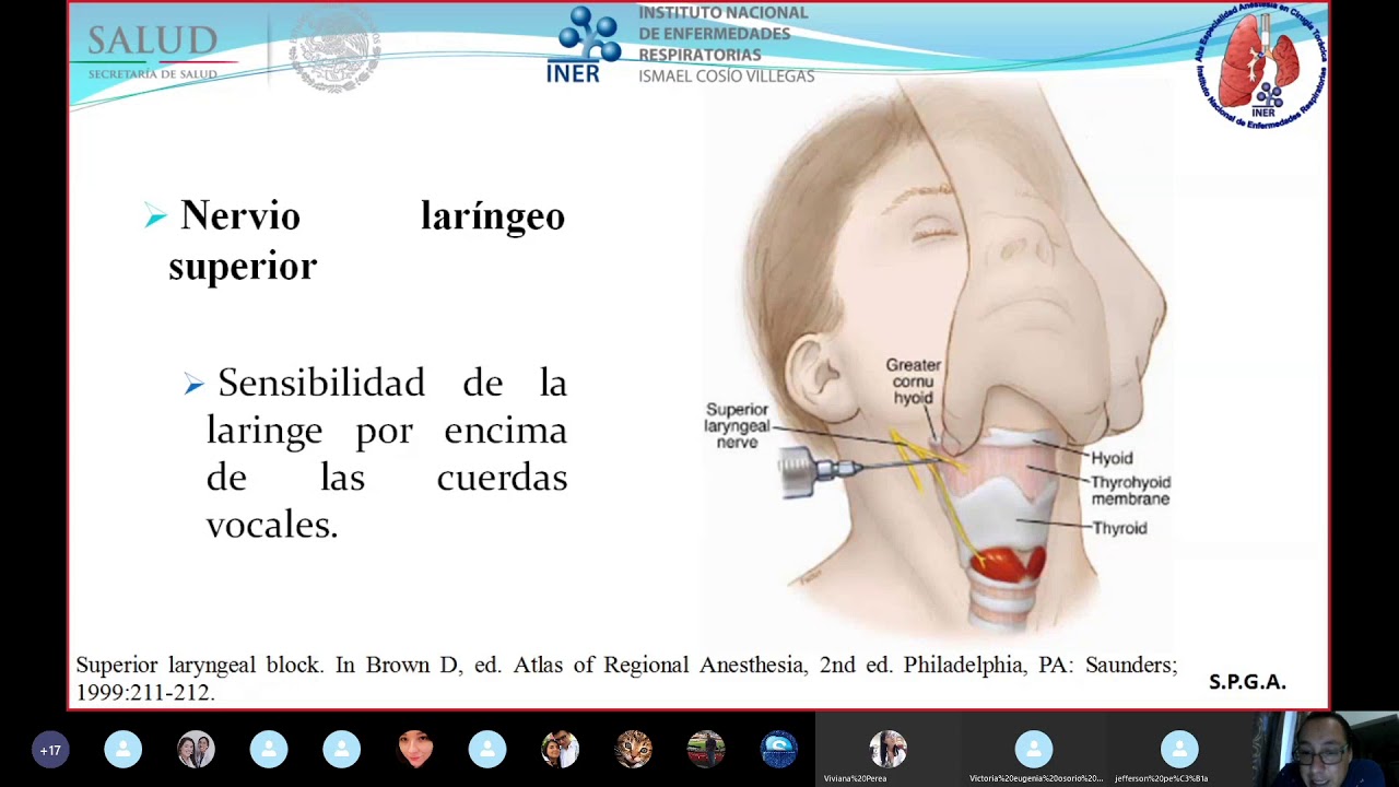 Anestesia en broncoscopia. PARTE 2