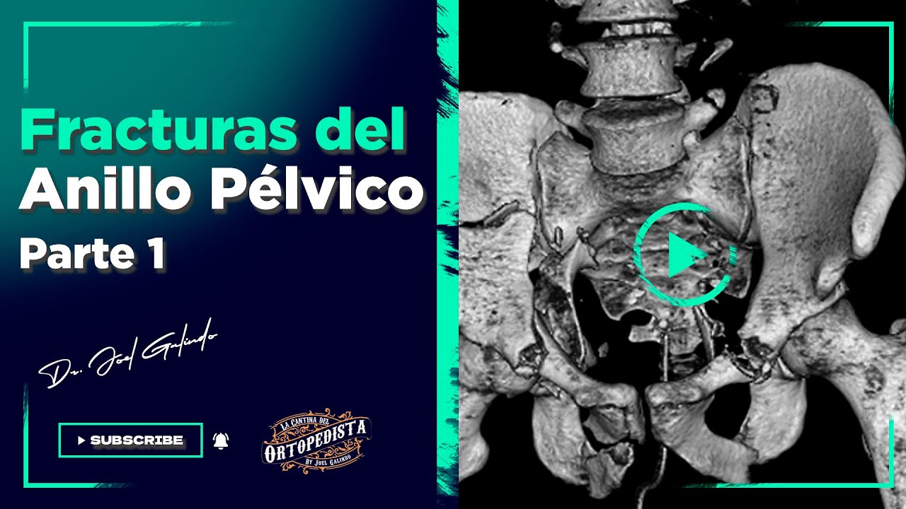 Fracturas del anillo pélvico | Primera Parte