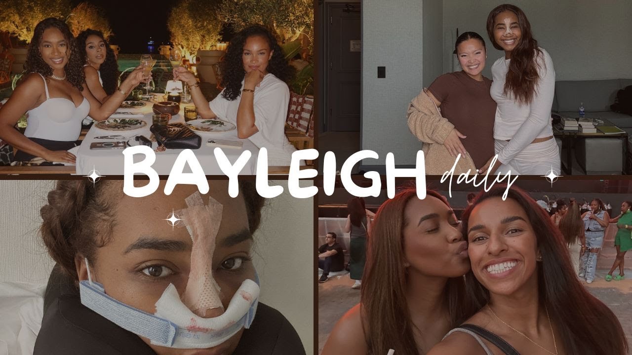 Nose Job Results Vlog! | Ethnic Rhinoplasty 💉🫢💡