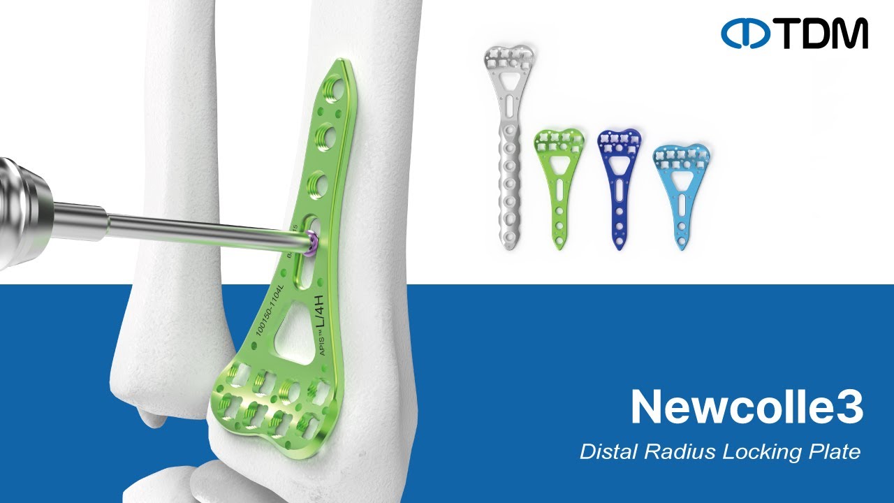 [TDM Korea] NewColle VA Distal Radius