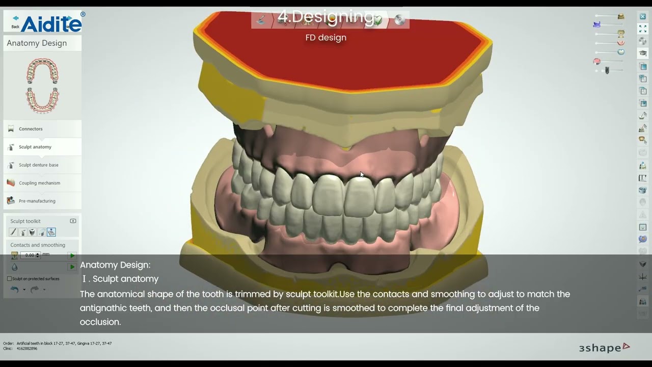 Aidite Digital Denture Solution | Easy, Precise, Comfortable & Aesthetic Workflow