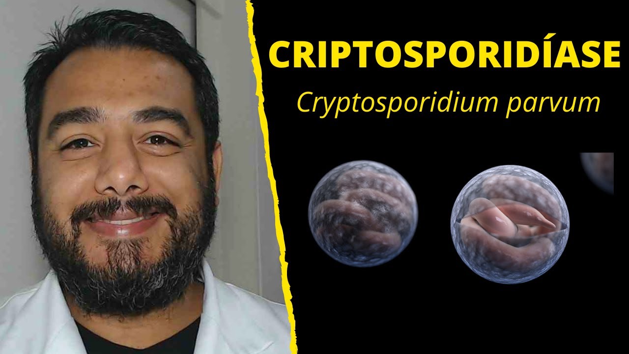 Criptosporidíase (Cryptosporidium parvum) | Curso de #Parasitologia Humana Básica e Clínica