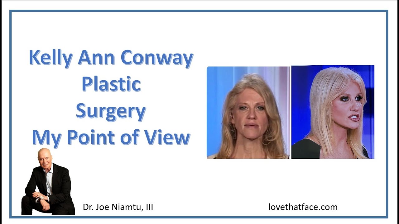 Kelly Ann Conway's Plastic Surgery: My Point of View