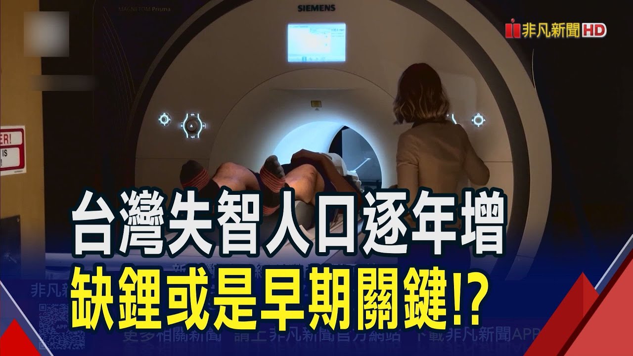 哈佛研究指大腦