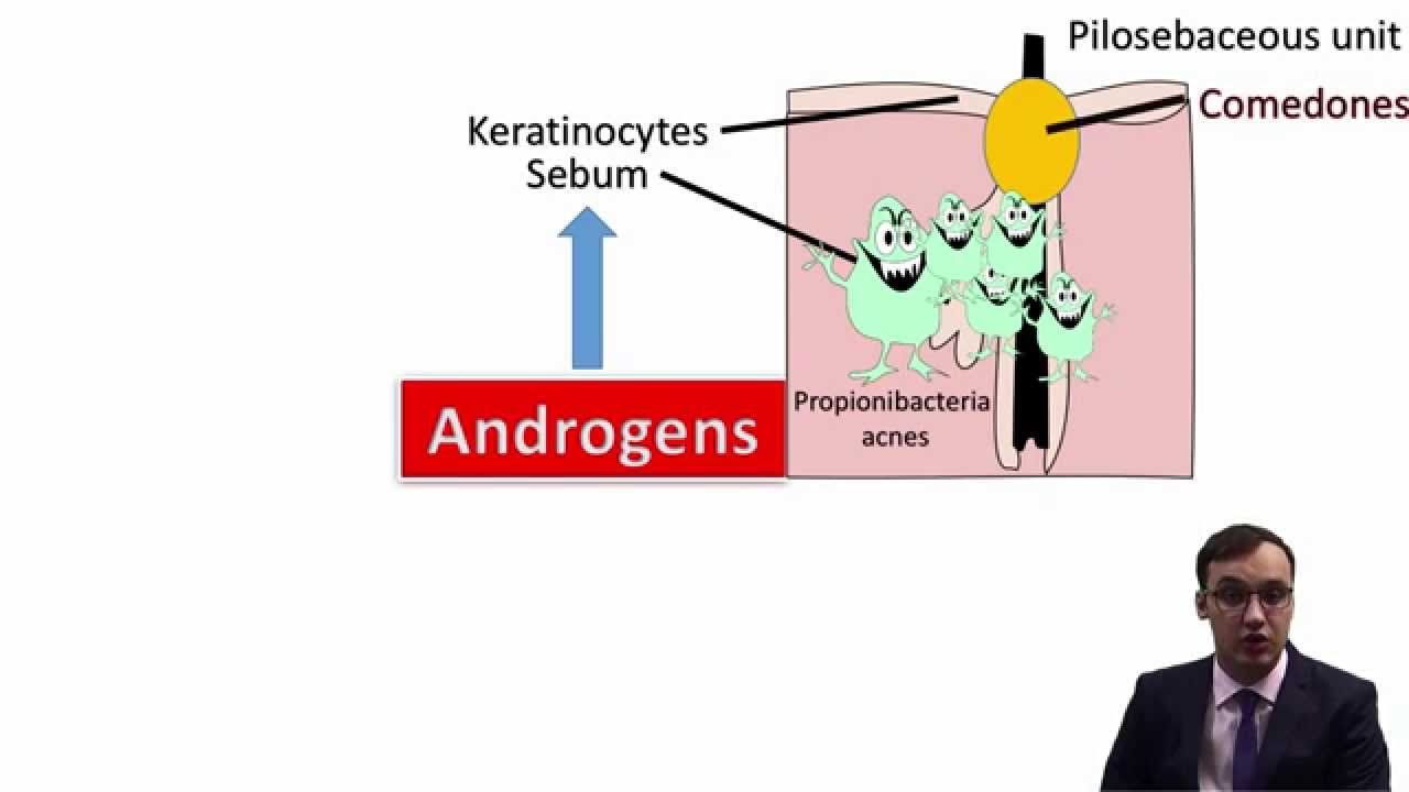 Acne Vulgaris