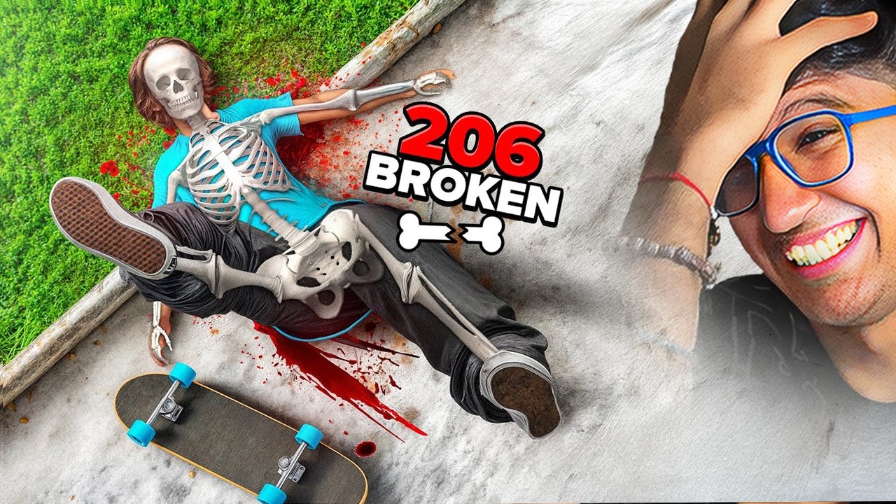 I BROKE ALL BONES IN MY BODY! (skate)