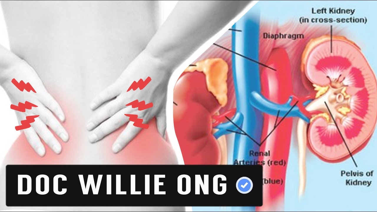 CREATININE PABABAIN: Masustansiyang Pagkain - Payo ni Doc Willie Ong #555b