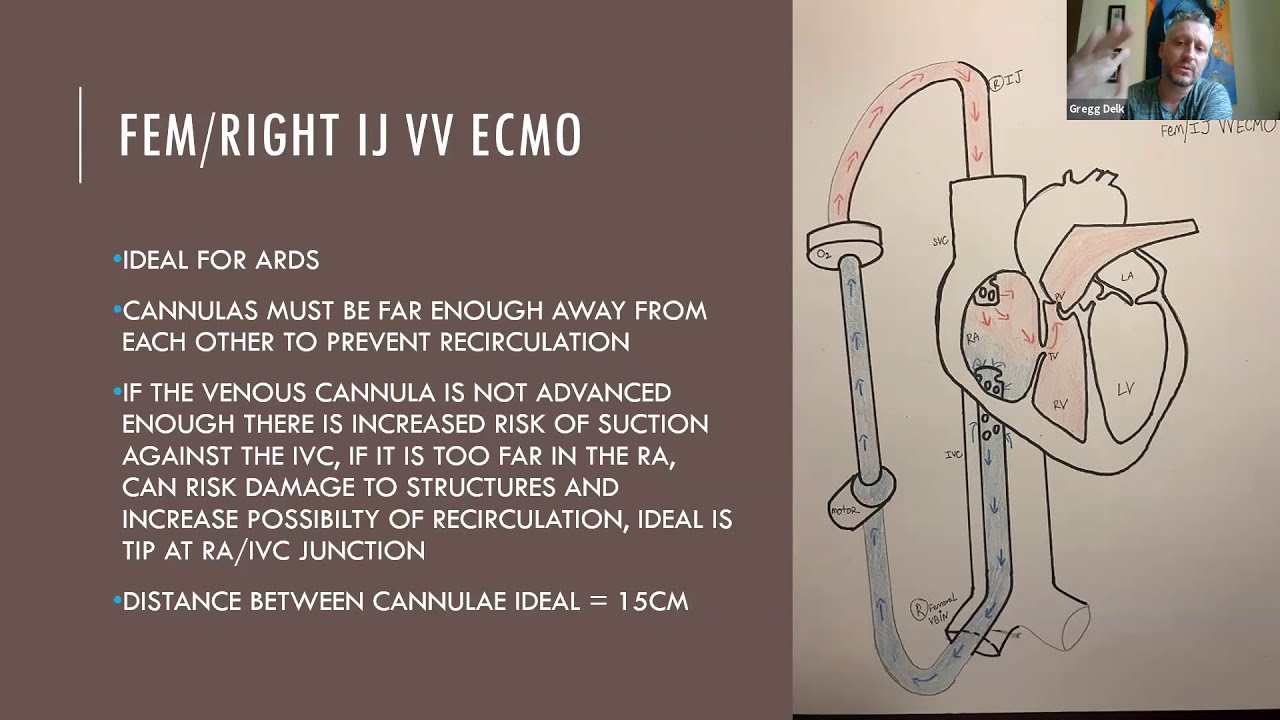 ECMO Cannulation - presented by Gregg Delk // ECMO Resource