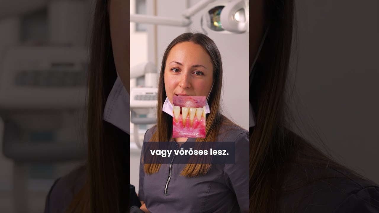 A fogorvos l&aacute;thatja, hogy sn&uuml;ssz&ouml;z&ouml;k? 🚭