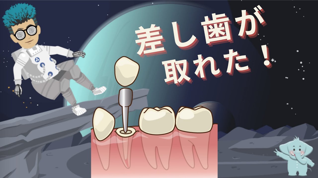 差し歯や仮歯、 ブリッジが取れた時、自分で出来る応急処置の方法
