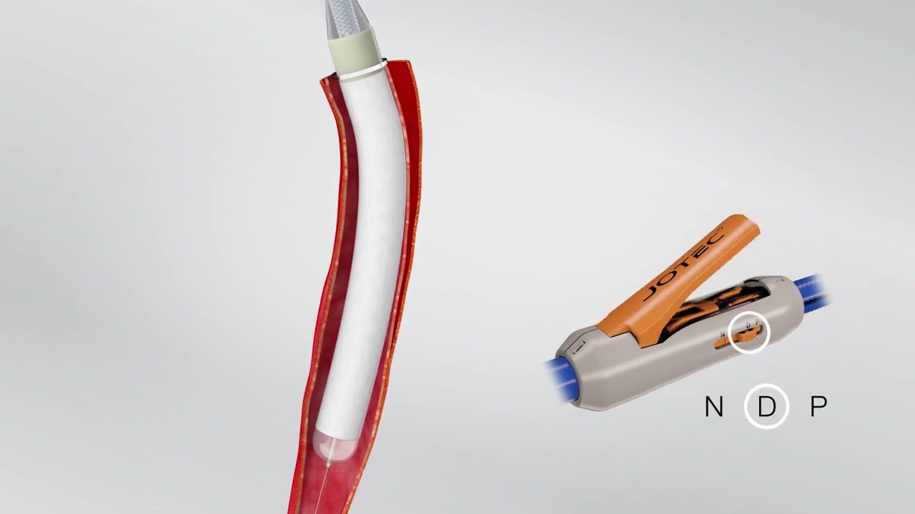 E-vita Open Plus Animation