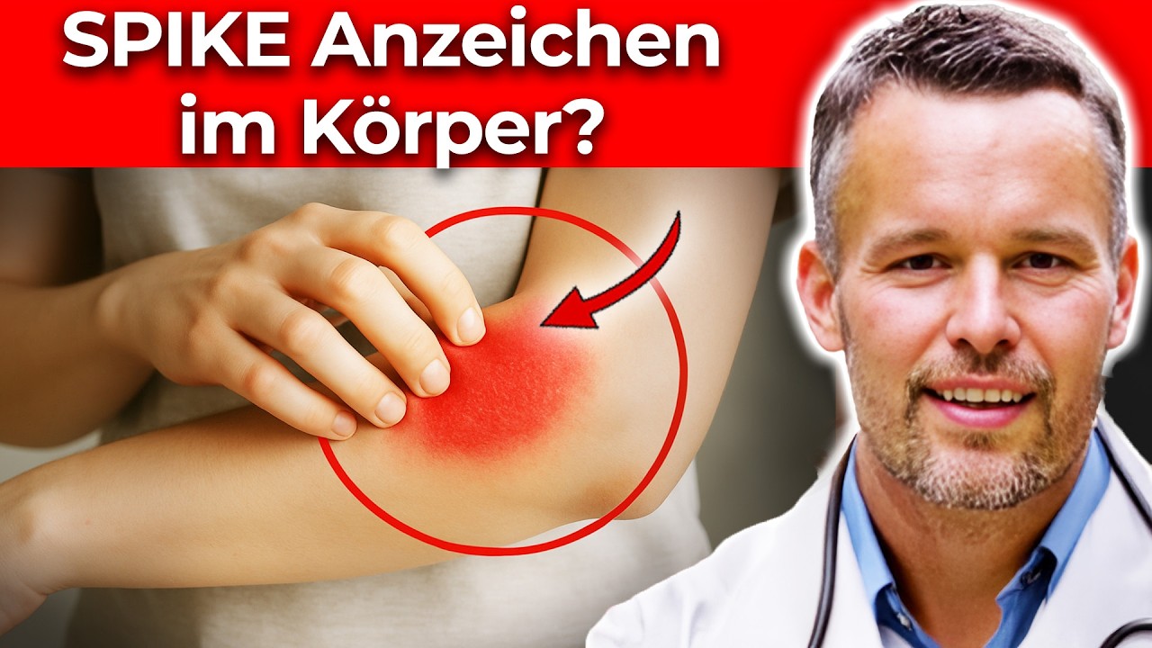 Histaminintoleranz: Nahrung ist NICHT das Problem (Arzt verrät Unbekanntes)