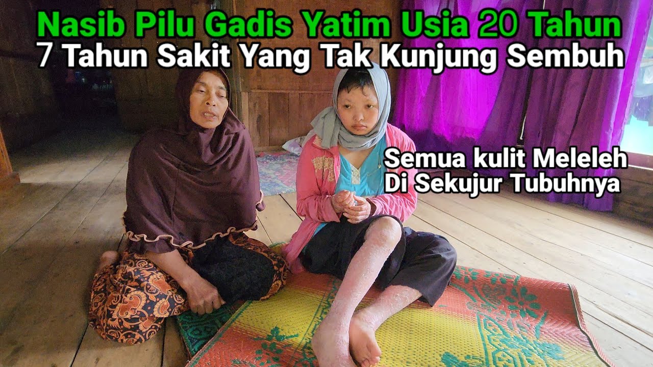 Memilukan Nasib Pilu Gadis Yatim Ci Anjur Selatan