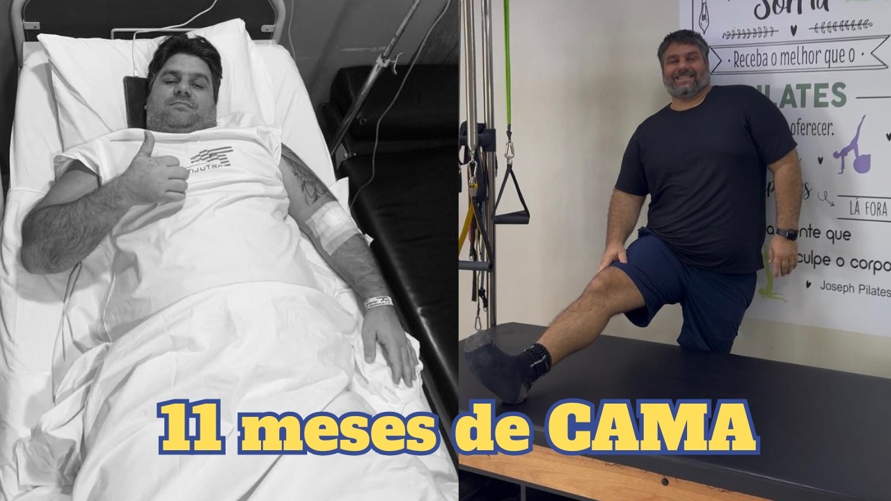 FIQUEI 11 MESES DE CAMA: A cirurgia que mudou meu corpo (Excesso de Bagagem #02)