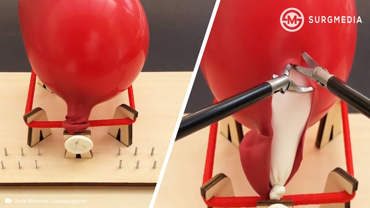 People Are Amazing: Ingenious and Admirable way of practicing Laparoscopic Cystectomy with Balloon