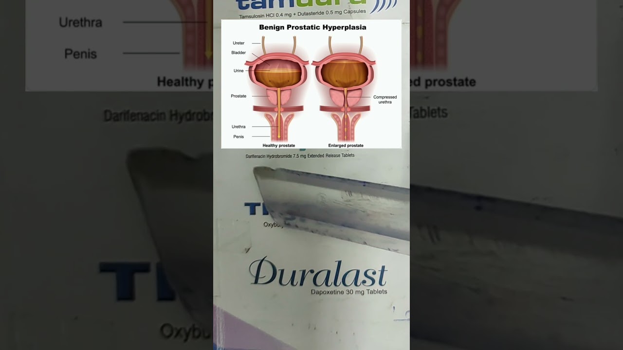 TropanXL (Oxybutynin) | Use, side effects, Dose, Precautions #medicine #pharma #share #viral
