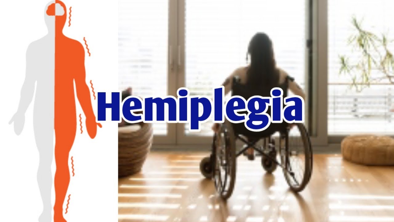 Partial Paralysis Hemiplegia & its Treatment