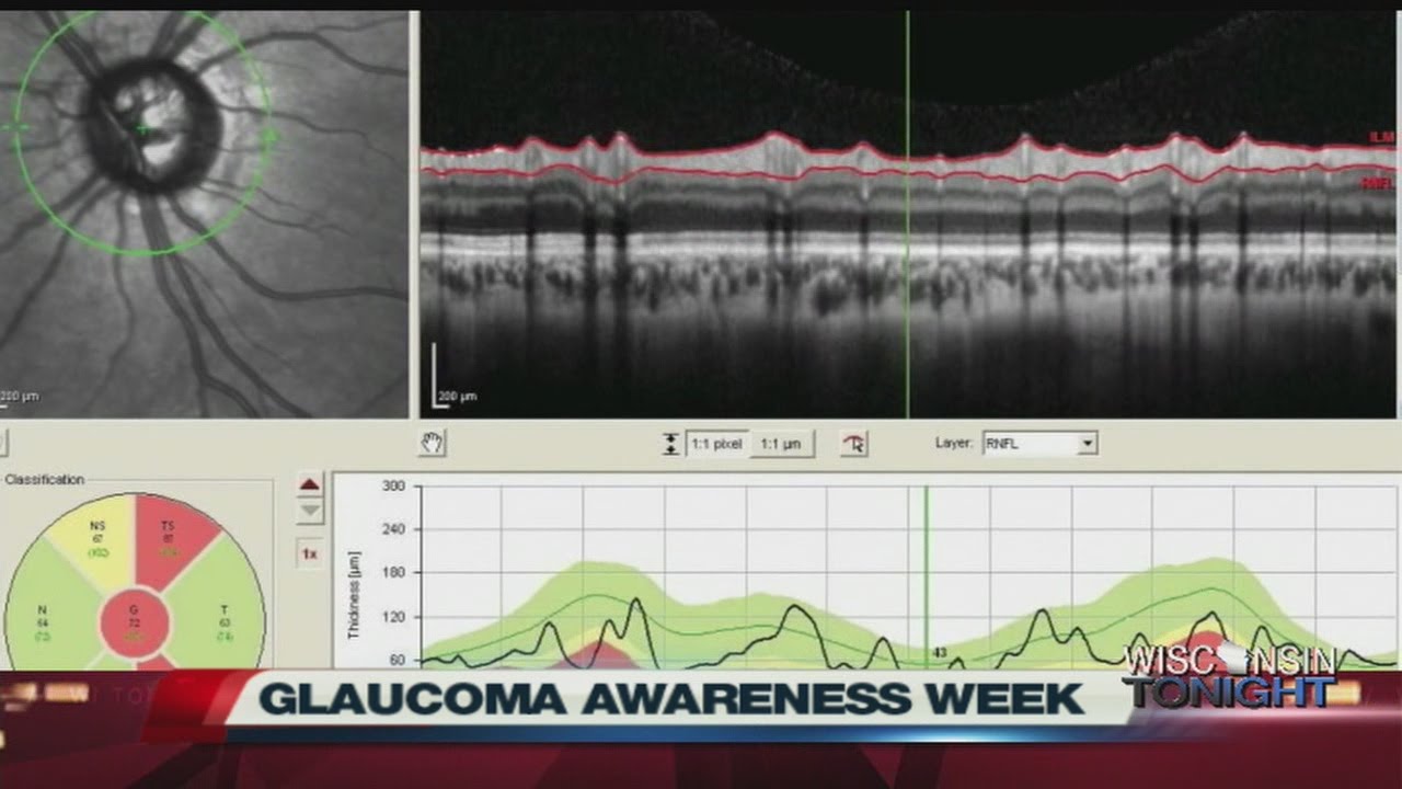 Glaucoma Awareness Week