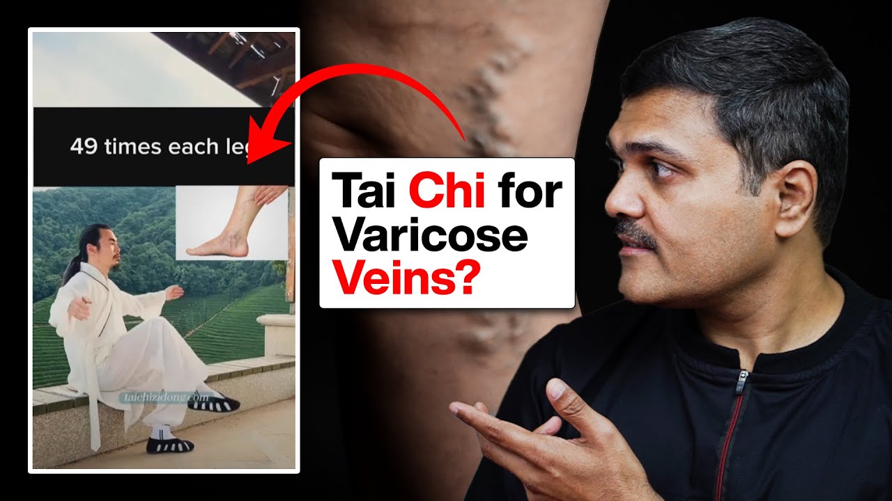 Have YOU Tried TAI-CHI for Varicose Veins?