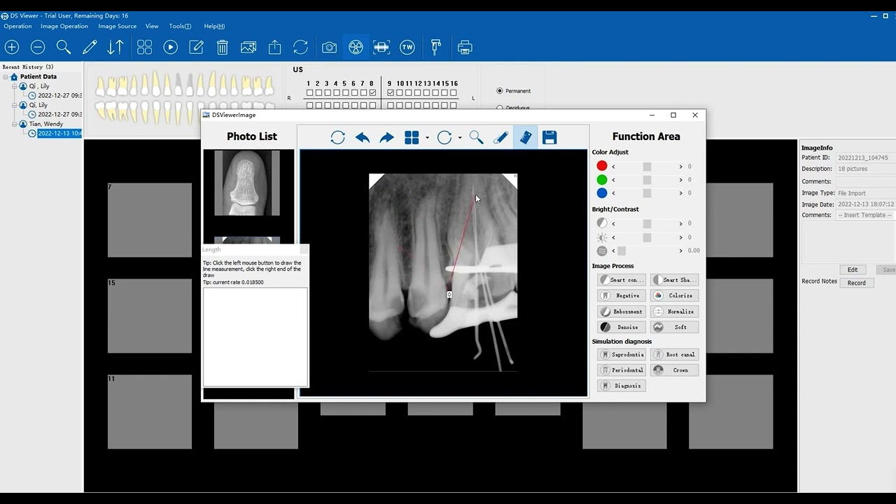 Carryx.S Dental Sensor For Teeth Imaging