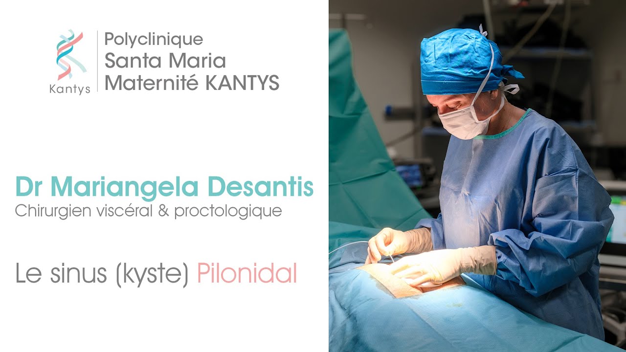 Le sinus (kyste) pilonidal, la prise en charge chirurgicale de la maladie à la Clinique Santa Maria