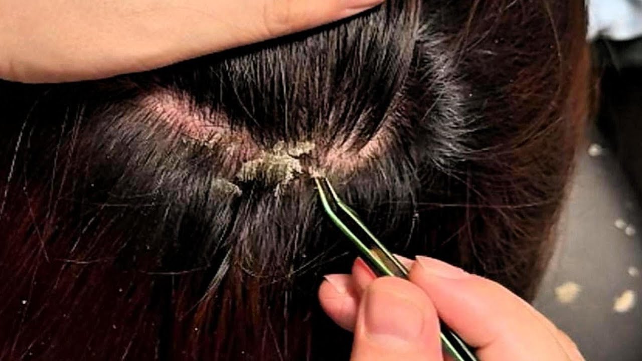 Jojo’s ASMR Scalp Care — Gentle Tweezer & Small Comb Movements for Calm Relaxation | No Talking
