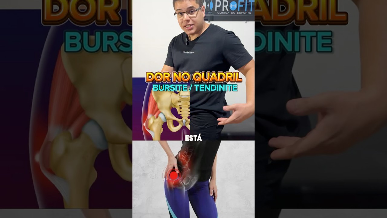 Dor no quadril: Bursite e Tendinopatia do quadril #quadril #dornoquadril #bursitetrocanterica
