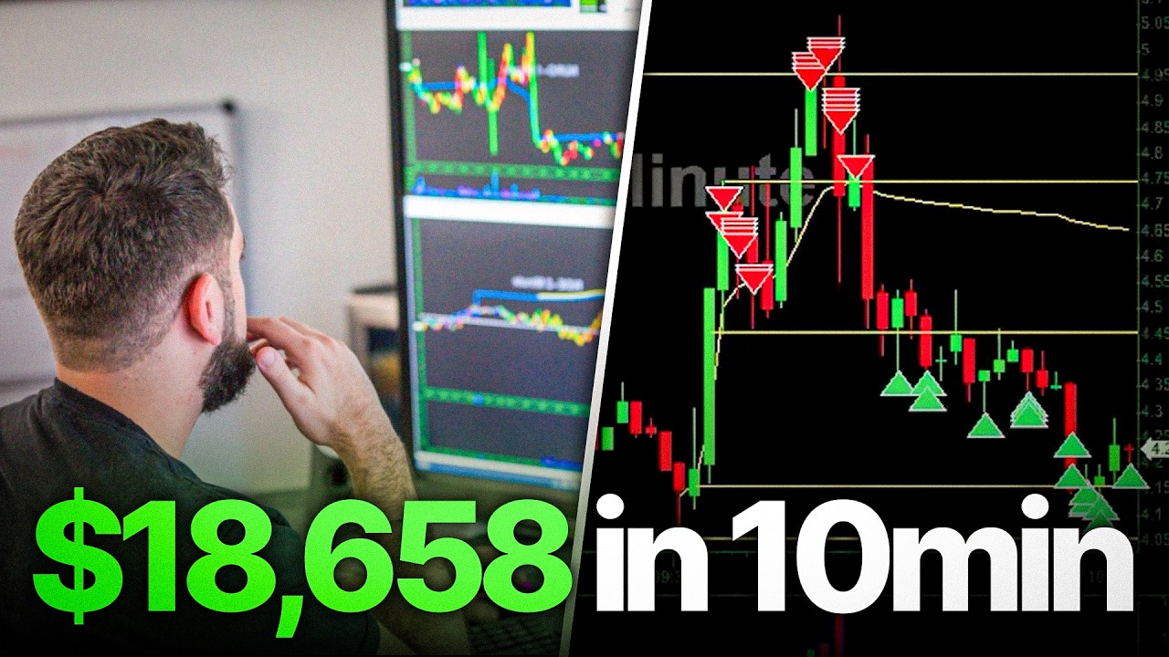 $16M Investor: Watch Me Make $18,658 PnL In Less Than 10 Minutes LIVE TRADING | Simple Strategy
