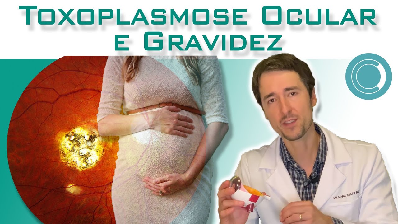 Tive toxoplasmose ocular, posso engravidar normalmente?