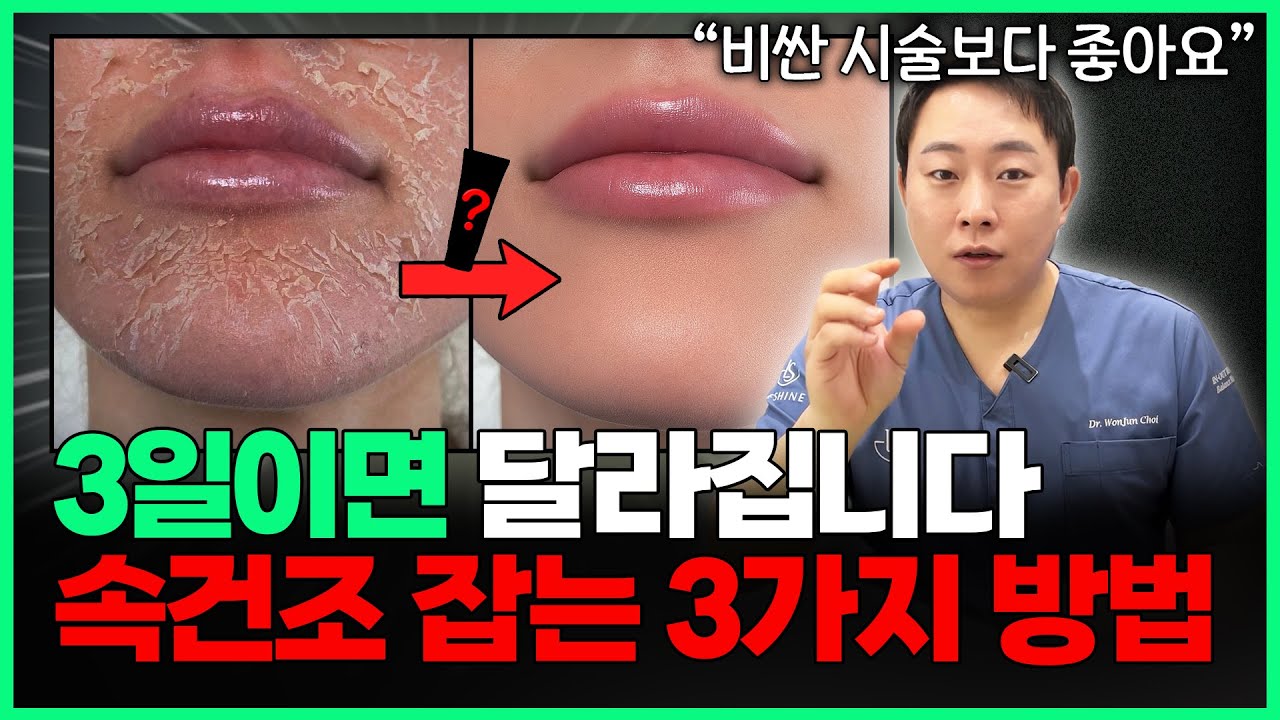 3분안에 알려주는 속건조 잡는 방법 