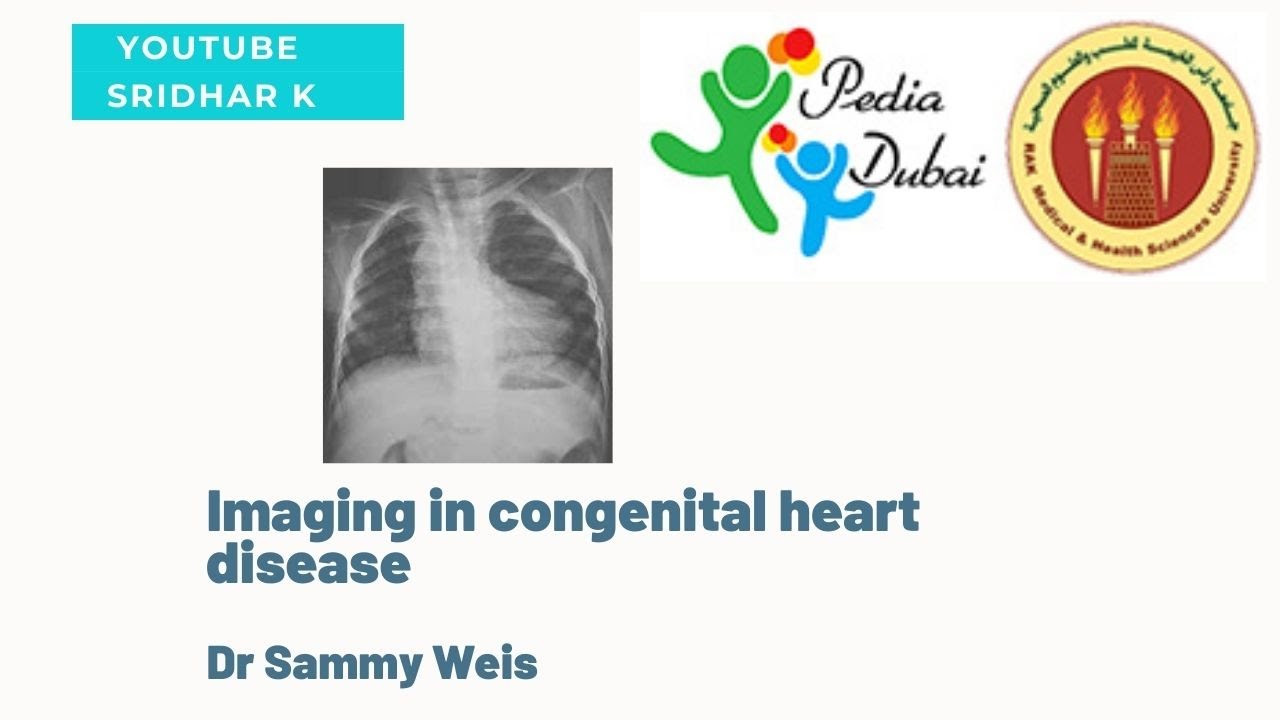 Imaging in congenital heart disease.  Dr Sammy Weis