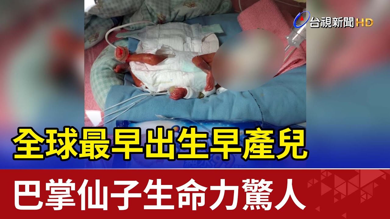 全球最早出生早產兒 巴掌仙子生命力驚人