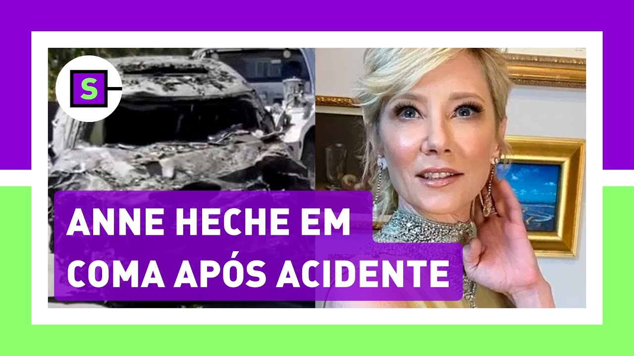 ANNE HECHE est&aacute; em COMA e estado &eacute; 'extremamente cr&iacute;tico' ap&oacute;s ACIDENTE