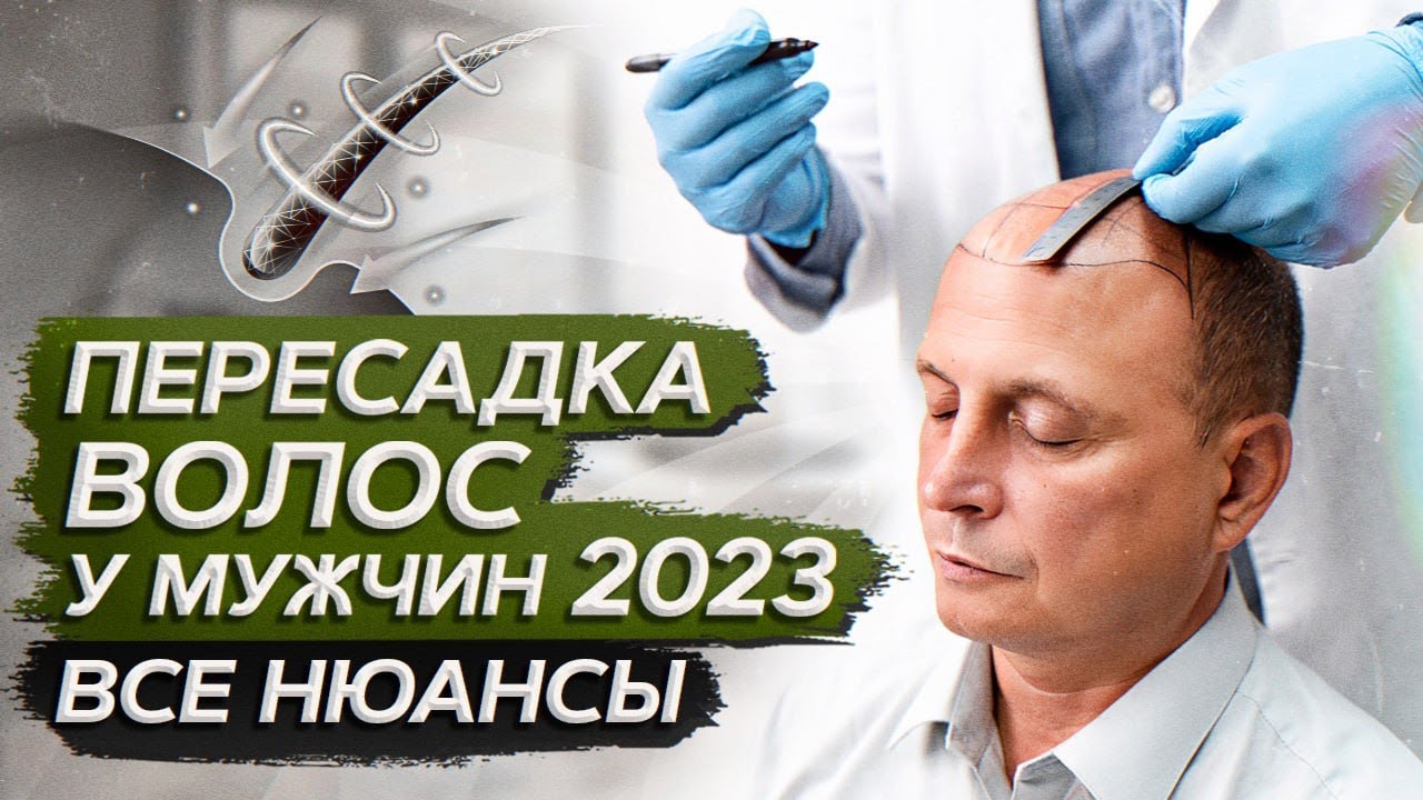 МУЖСКАЯ пересадка ВОЛОС в 2023 ГОДУ! / Нюансы и рекомендации по пересадке волос для мужского пола