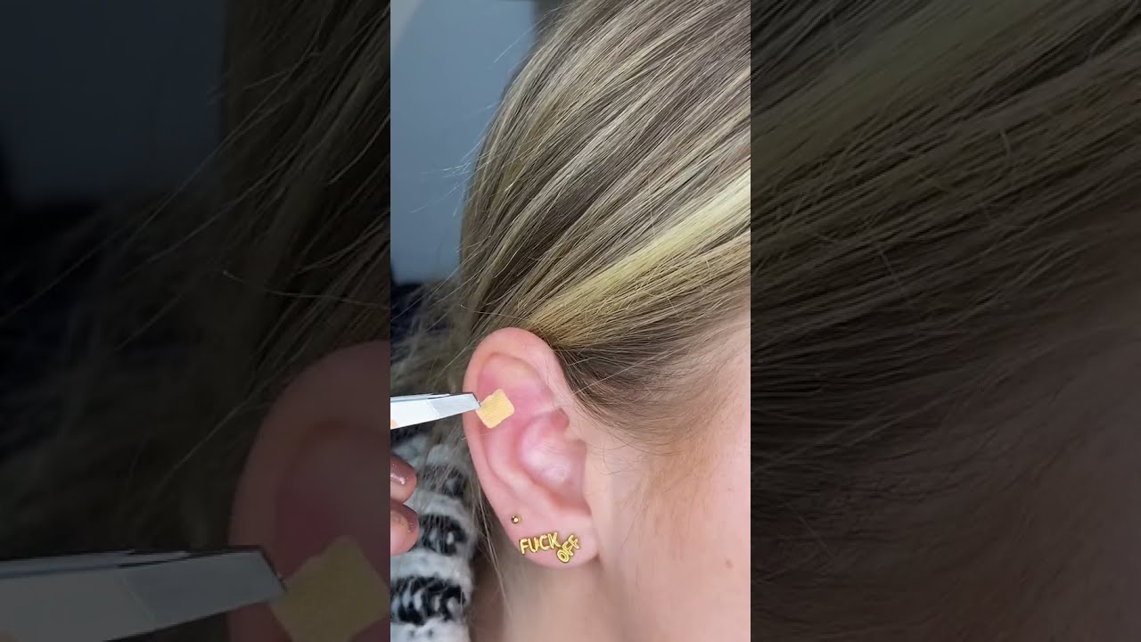 Do ear seeds work? | #Shorts