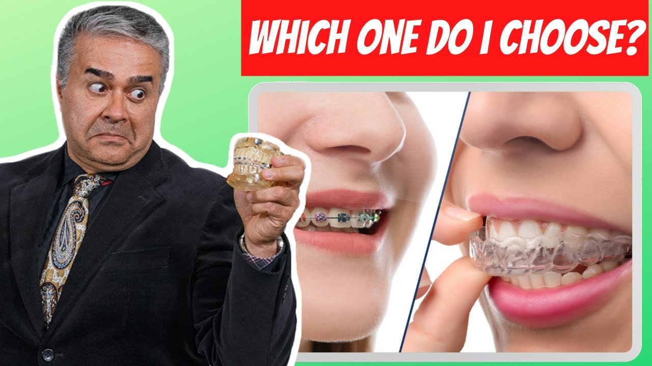 BRACES VS. INVISALIGN? | Dr. G Gives the Definitive Answer
