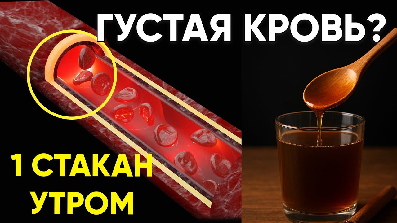 Боитесь тромбов? Этот утренний напиток и 3 ошибки, которые сгущают кровь, изменят вашу жизнь!