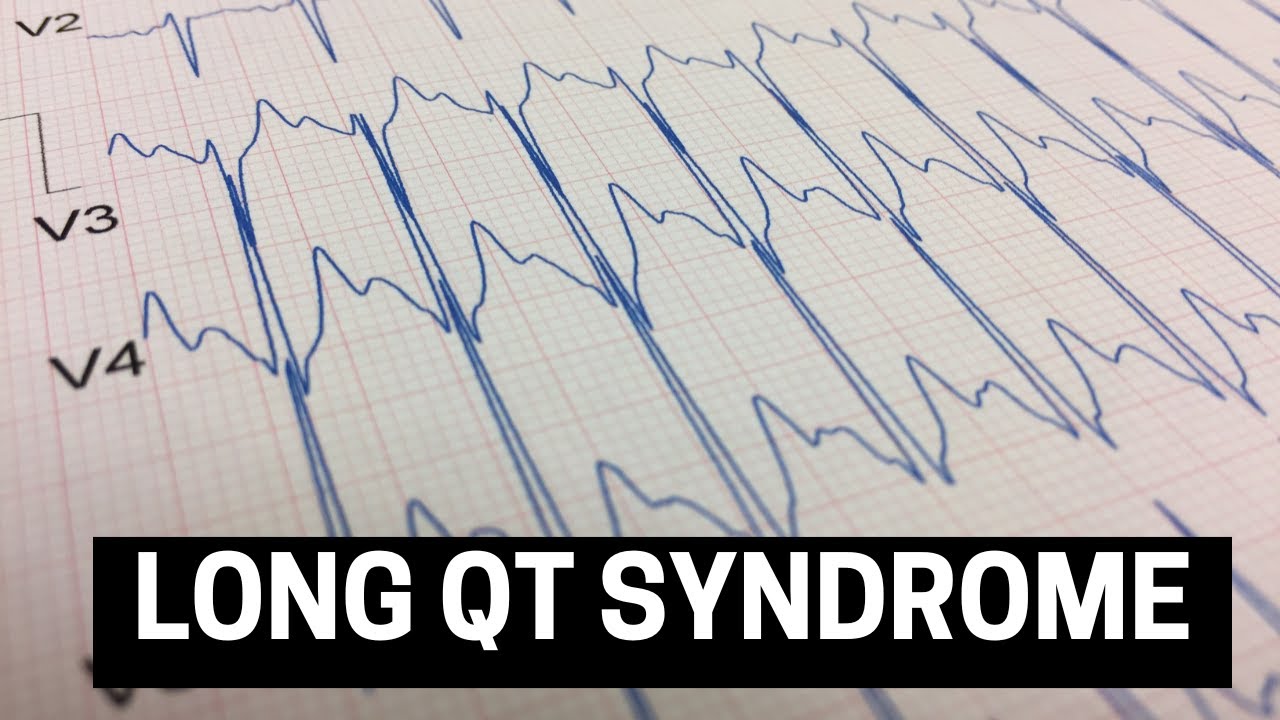 Understanding Long QT Syndrome (LQTS): Symptoms, Diagnosis, & Treatment