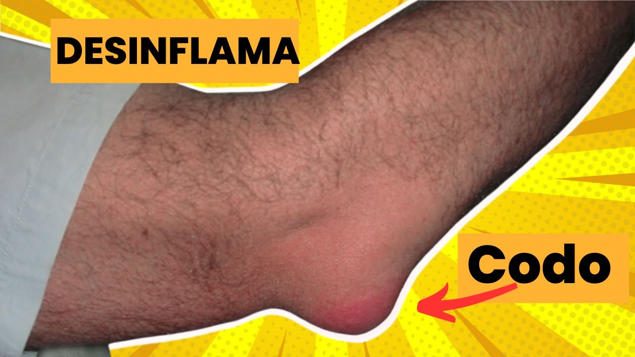 ✅👌 pontente ejercicio DESINFLAMAR CODO