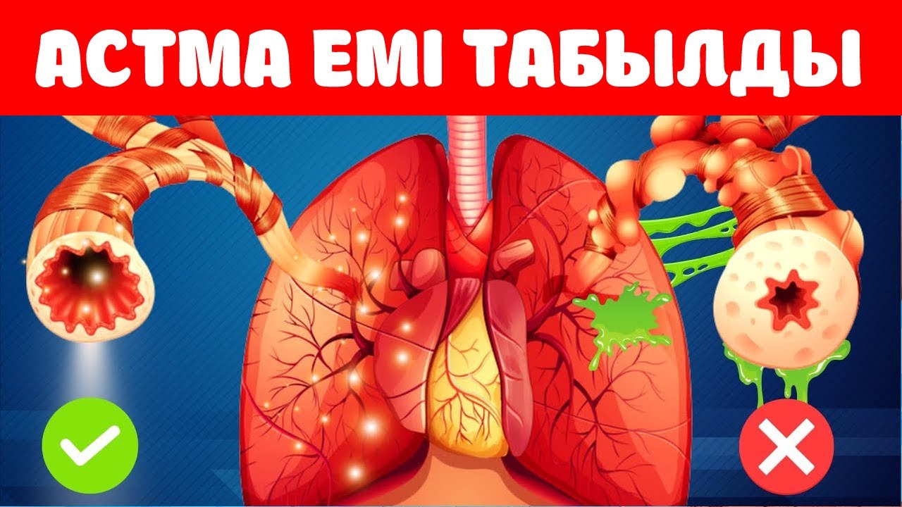 Астма Ауруымен 16 ЖЫЛ АУЫРЫП ЕМІН ТАПТЫ, Астма Ауруынан емделу, Керек арнасы