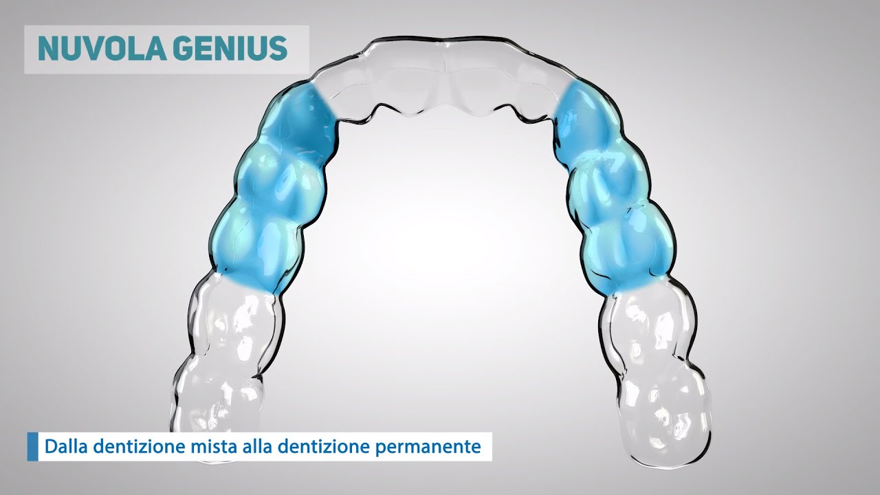Video 3D Presentazione Allineatori Dentali
