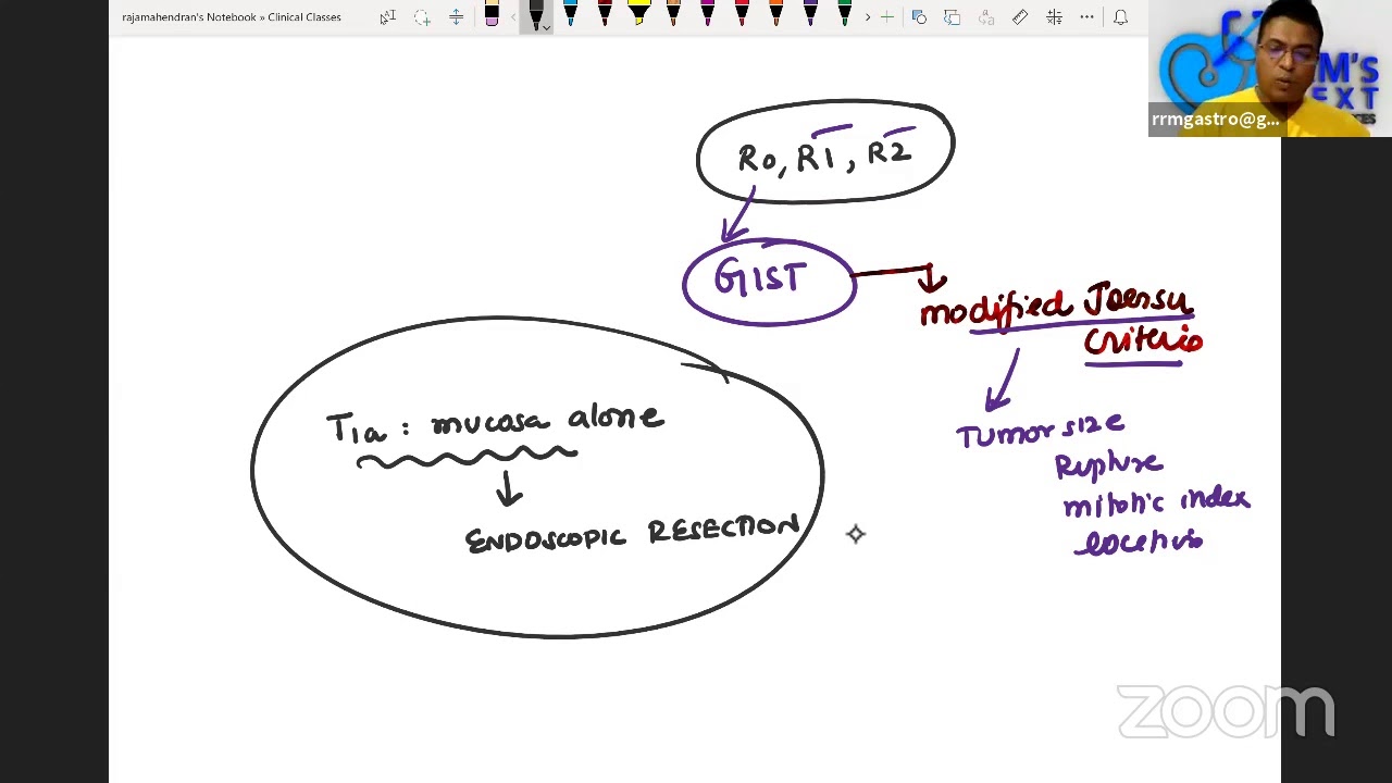 Epigastric mass Clinical case discussion - by Dr. Rajamahendran MCh