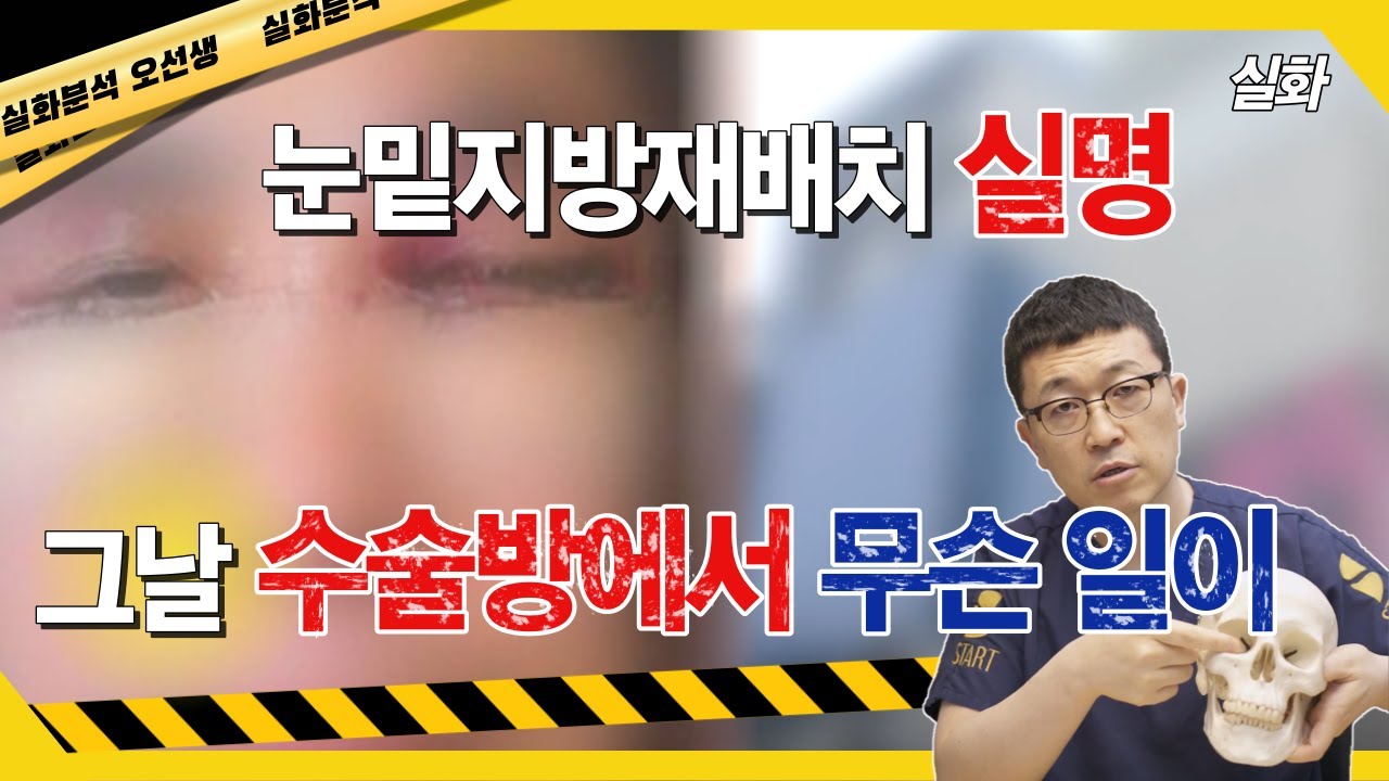 눈밑지방재배치 실명. 그날 수술방에서 무슨 일이 있었던 것일까?!