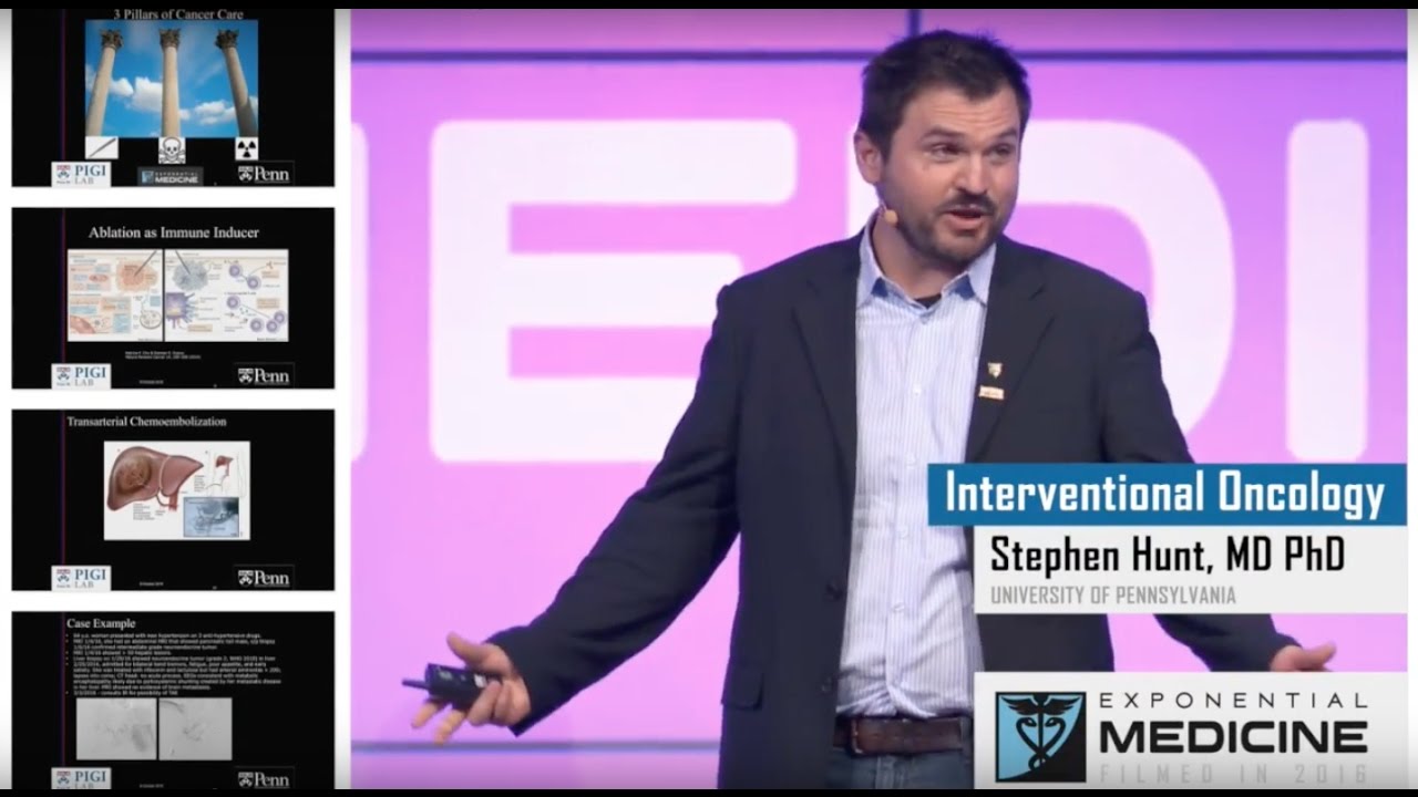 The Future of Interventional Oncology | Dr. Stephen Hunt at Exponential Medicine 2016