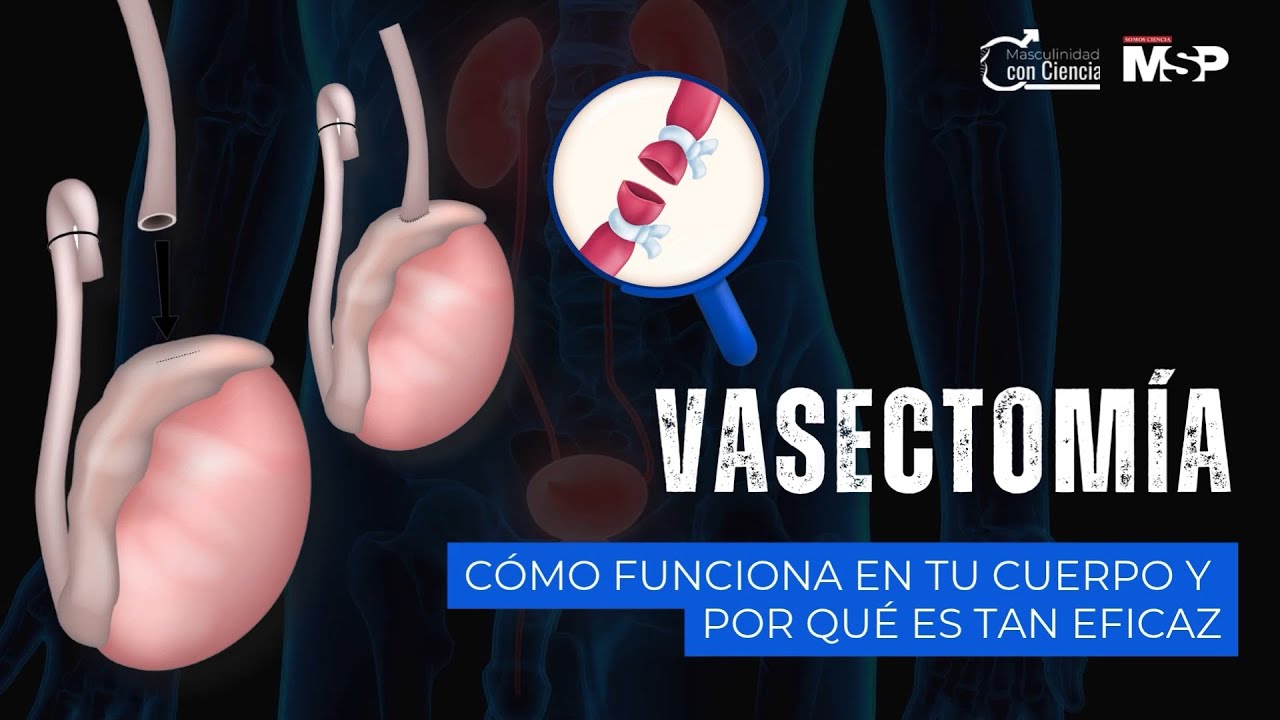 Vasectom&iacute;a: &iquest;C&oacute;mo funciona en tu cuerpo y por qu&eacute; es tan eficaz?